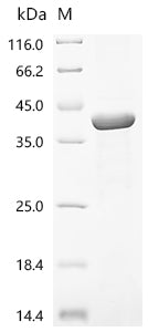 (Tris-Glycine gel) Discontinuous SDS-PAGE (reduced) with 5% enrichment gel and 15% separation gel.