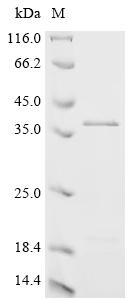 (Tris-Glycine gel) Discontinuous SDS-PAGE (reduced) with 5% enrichment gel and 15% separation gel.