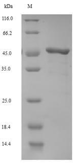(Tris-Glycine gel) Discontinuous SDS-PAGE (reduced) with 5% enrichment gel and 15% separation gel.