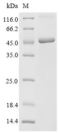 Recombinant Simian retrovirus SRV-1 Envelope glycoprotein (env), partial – Figure 1 of 1