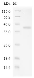 (Tris-Glycine gel) Discontinuous SDS-PAGE (reduced) with 5% enrichment gel and 15% separation gel.