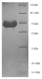 Recombinant Bacillus subtilis Subtilisin E (aprE) – Figure 1 of 1