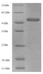 Recombinant Influenza A virus Hemagglutinin (HA) – Figure 1 of 1