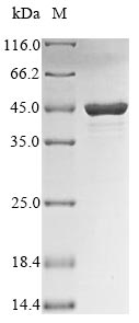 Recombinant Influenza B virus Nucleoprotein (NP), partial – Figure 1 of 1