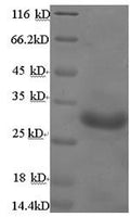 Recombinant Bordetella pertussis Pertussis toxin subunit 1 (ptxA) – Figure 1 of 1
