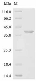 (Tris-Glycine gel) Discontinuous SDS-PAGE (reduced) with 5% enrichment gel and 15% separation gel.