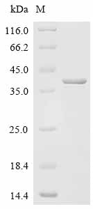 (Tris-Glycine gel) Discontinuous SDS-PAGE (reduced) with 5% enrichment gel and 15% separation gel.