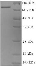 Recombinant Bacillus subtilis Levanase (sacC) – Figure 1 of 1