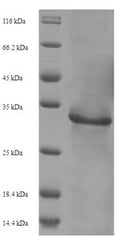 Recombinant Human immunodeficiency virus type 2 subtype A Protein Vpx (vpx) – Figure 1 of 1