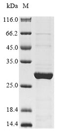 (Tris-Glycine gel) Discontinuous SDS-PAGE (reduced) with 5% enrichment gel and 15% separation gel.