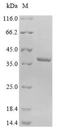 (Tris-Glycine gel) Discontinuous SDS-PAGE (reduced) with 5% enrichment gel and 15% separation gel.