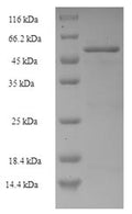 Recombinant Escherichia coli Methyl-accepting chemotaxis protein II (tar), partial – Figure 1 of 1