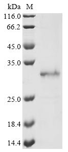 (Tris-Glycine gel) Discontinuous SDS-PAGE (reduced) with 5% enrichment gel and 15% separation gel.