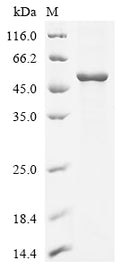 (Tris-Glycine gel) Discontinuous SDS-PAGE (reduced) with 5% enrichment gel and 15% separation gel.