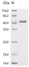 (Tris-Glycine gel) Discontinuous SDS-PAGE (reduced) with 5% enrichment gel and 15% separation gel.