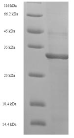 Recombinant Escherichia coli 8-oxo-dGTP diphosphatase (mutT) – Figure 1 of 1