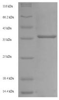 Recombinant Mouse Low affinity immunoglobulin gamma Fc region receptor III (Fcgr3), partial – Figure 1 of 1