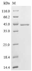 (Tris-Glycine gel) Discontinuous SDS-PAGE (reduced) with 5% enrichment gel and 15% separation gel.