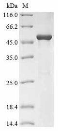 (Tris-Glycine gel) Discontinuous SDS-PAGE (reduced) with 5% enrichment gel and 15% separation gel.