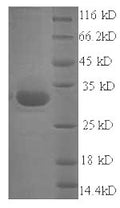 Recombinant Staphylococcus aureus Exfoliative toxin A (eta) – Figure 1 of 1