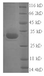 Recombinant Staphylococcus aureus Exfoliative toxin A (eta) – Figure 1 of 1