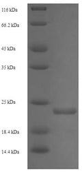 Recombinant Enterobacteria phage 933W Shiga-like toxin 2 subunit B (stxB2) – Figure 1 of 1
