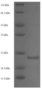 Recombinant Enterobacteria phage 933W Shiga-like toxin 2 subunit B (stxB2) – Figure 1 of 1