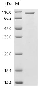 (Tris-Glycine gel) Discontinuous SDS-PAGE (reduced) with 5% enrichment gel and 15% separation gel.