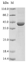 (Tris-Glycine gel) Discontinuous SDS-PAGE (reduced) with 5% enrichment gel and 15% separation gel.