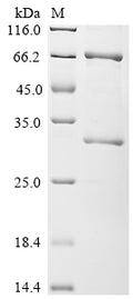 (Tris-Glycine gel) Discontinuous SDS-PAGE (reduced) with 5% enrichment gel and 15% separation gel.