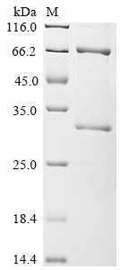 (Tris-Glycine gel) Discontinuous SDS-PAGE (reduced) with 5% enrichment gel and 15% separation gel.