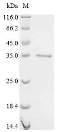 (Tris-Glycine gel) Discontinuous SDS-PAGE (reduced) with 5% enrichment gel and 15% separation gel.