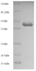 Recombinant Staphylococcus aureus Enterotoxin type C-3 (entC3) – Figure 1 of 1