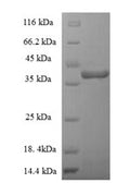 (Tris-Glycine gel) Discontinuous SDS-PAGE (reduced) with 5% enrichment gel and 15% separation gel.