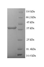 Recombinant Staphylococcus aureus Enterotoxin type H (entH) – Figure 1 of 1