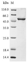 (Tris-Glycine gel) Discontinuous SDS-PAGE (reduced) with 5% enrichment gel and 15% separation gel.