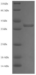 Recombinant Streptomyces lividans DNA-binding protein HU 1 (hup1) – Figure 1 of 1
