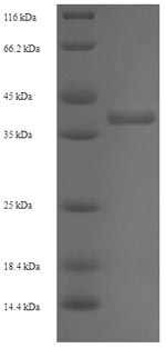 Recombinant Streptomyces lividans DNA-binding protein HU 1 (hup1) – Figure 1 of 1