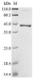 (Tris-Glycine gel) Discontinuous SDS-PAGE (reduced) with 5% enrichment gel and 15% separation gel.