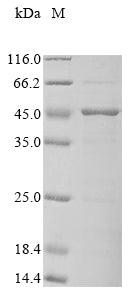(Tris-Glycine gel) Discontinuous SDS-PAGE (reduced) with 5% enrichment gel and 15% separation gel.