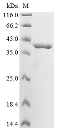 (Tris-Glycine gel) Discontinuous SDS-PAGE (reduced) with 5% enrichment gel and 15% separation gel.