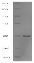 Recombinant Escherichia coli Peptidyl-tRNA hydrolase (pth) – Figure 1 of 1