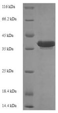 Recombinant Escherichia coli Recombination protein RecR (recR) – Figure 1 of 1