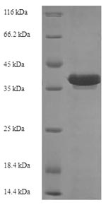 Recombinant Escherichia coli Recombination protein RecR (recR) – Figure 1 of 1