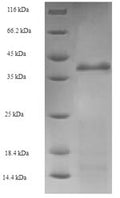 Recombinant Escherichia coli Holliday junction ATP-dependent DNA helicase RuvA (ruvA) – Figure 1 of 1