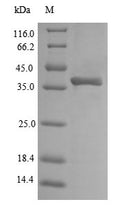 (Tris-Glycine gel) Discontinuous SDS-PAGE (reduced) with 5% enrichment gel and 15% separation gel.