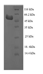Recombinant Escherichia coli Glutamate-pyruvate aminotransferase AlaA (alaA) – Figure 1 of 1