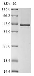 (Tris-Glycine gel) Discontinuous SDS-PAGE (reduced) with 5% enrichment gel and 15% separation gel.