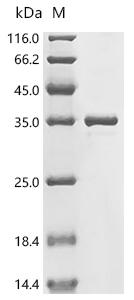 Recombinant Escherichia coli Aerobic respiration control protein ArcA (arcA) – Figure 1 of 1