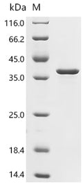 (Tris-Glycine gel) Discontinuous SDS-PAGE (reduced) with 5% enrichment gel and 15% separation gel.